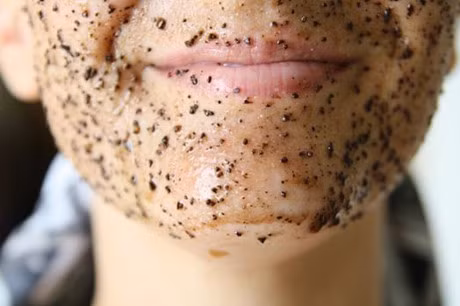 Nhung li do khien du troi nong do mo van lam da ban bi kho troc - Anh 4