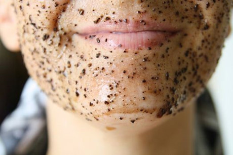 Những lí do khiến dù trời nóng đổ mỡ vẫn làm da bạn bị khô tróc - Ảnh 4 Nhung li do khien du troi nong do mo van lam da ban bi kho troc - Anh 4