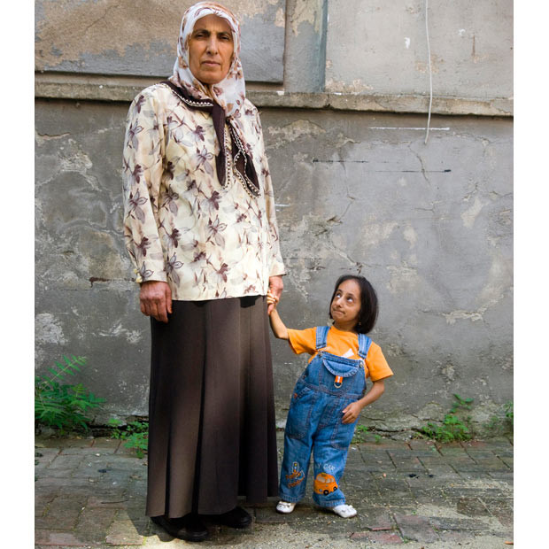Hatice Kocaman, 21, is the smallest woman in the world. She is just 28 inches tall and weighs only 15lbs, about the same as an eight-month-old baby. She lives with her parents in Kadirli, Osmaniye, Turkey. The country is also home to the world’s tallest man
