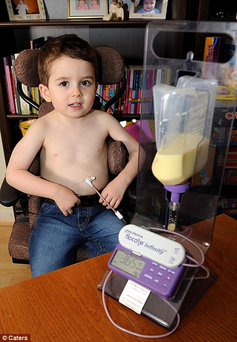 Battler: Daniel Harrison’ calm demeanor hides a struggle for survival living with a rare condition that prevents himself from eating or drinking Read more: http://www.dailymail.co.uk/health/article-1326144/Four-year-old-boy-scared-food-eaten.html#ixzz145XyPgOn