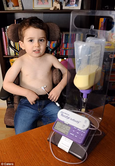 Cách duy nhất để đưa thức ăn vào cơ thể Daniel Harrison là qua một ống dẫn vào dạ dày Battler: Daniel Harrison’ calm demeanor hides a struggle for survival living with a rare condition that prevents himself from eating or drinking Read more: http://www.dailymail.co.uk/health/article-1326144/Four-year-old-boy-scared-food-eaten.html#ixzz145XyPgOn