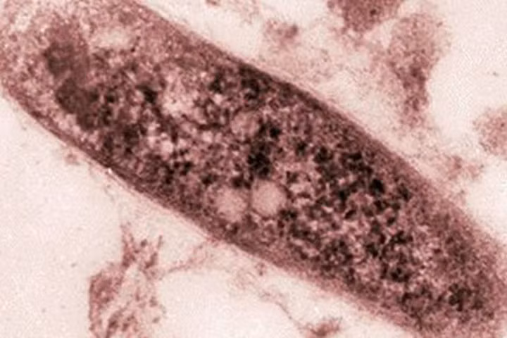 Cảnh báo chủng lao siêu kháng thuốc gia tăng