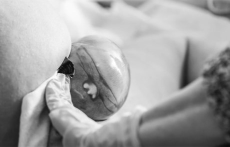 Đẻ con lần thứ 4, bà mẹ sững sờ khi phát hiện ra điều kỳ lạ này! - Ảnh 8 De con lan thu 4, ba me sung so khi phat hien ra dieu ky la nay! - Anh 8