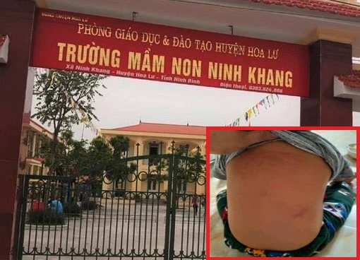 Trường Mầm non Ninh Khang