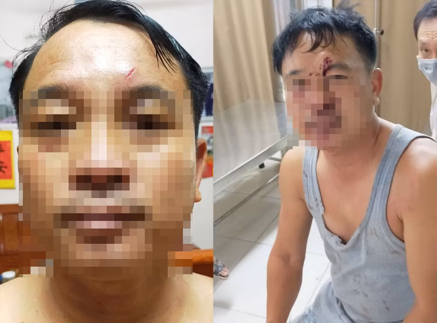 Anh Lập với vết thương trên mặt được cho là do nhóm đối tượng gây ra