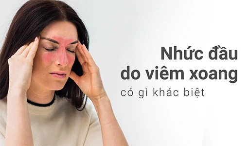 Nhức đầu do viêm xoang thường bị nhầm với đau nửa đầu