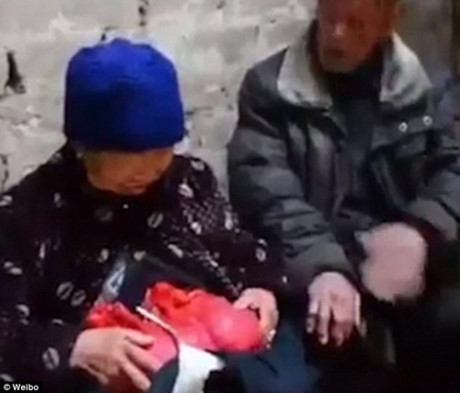 Cu ba song hang thap ky voi tinh trang ruot loi ben ngoai co the - Anh 2