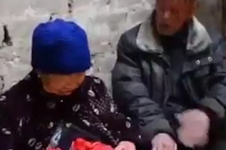 Cụ bà sống hàng thập kỷ với tình trạng ruột lòi bên ngoài cơ thể