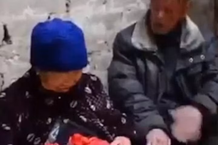 Cụ bà sống hàng thập kỷ với tình trạng ruột lòi bên ngoài cơ thể