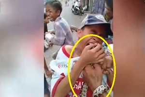 Video: Thiếu niên bị trăn cắn vào lưỡi chảy máu vì màn nghịch dại