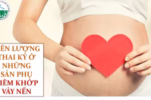 Viêm khớp vảy nến có ảnh hưởng đến phụ nữ mang thai không?