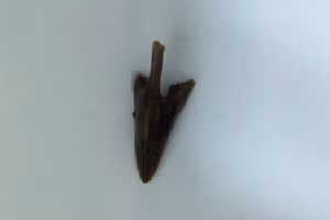 Mảnh mỏ gà bị rơi vào phế quản khi ăn bệnh nhân được lấy ra thành công. Ảnh: BV.