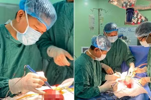 Đại phẫu khối u máu trong gan cho bé 14 ngày tuổi 