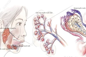 Hình ảnh giải phẫu tuyến nước bọt Ẩn bớt. Nguồn: BV.