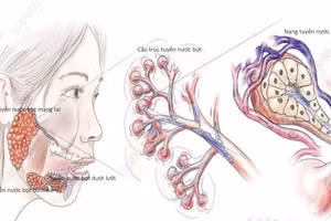 Hình ảnh giải phẫu tuyến nước bọt Ẩn bớt. Nguồn: BV.