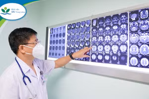 TS.BS Cao Vũ Hùng – Giám đốc Trung tâm Thần Kinh, Bệnh viện Nhi Trung ương. Nguồn: Bệnh viện Nhi Trung ương.