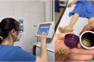 Viên tiểu đường hoàn mà bệnh nhân tự ý sử dụng khiến bản thân "gặp họa". Ảnh: BS.