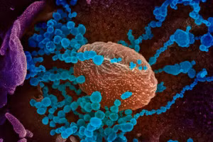 Deltacron và Stealth Omicron là các biến thể phụ của Covid đang được theo dõi. Ảnh: Viện Y tế Quốc gia Mỹ/AFP.