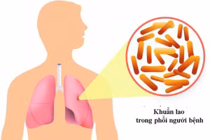 Ảnh minh họa, nguồn: SKĐS