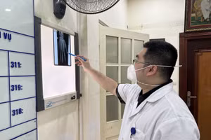 Bác sĩ kiểm tra phim chụp tổn thương của bệnh nhân. Ảnh: BV.