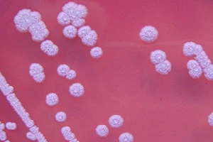 Vi khuẩn Burkholderia Pseudomalle. Ảnh: VTV