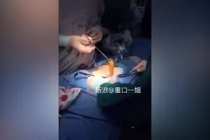 Video: Kinh ngạc gắp lươn sống đang giãy trong bụng nam thanh niên