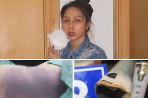 Bị can Nguyễn Võ Quỳnh Trang và các dấu tích của vụ bạo hành. Ảnh: CACC.