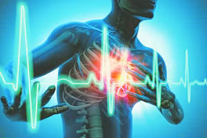 Rối loạn nhịp tim đang là nguyên nhân của rất nhiều trường hợp đột tử hiện nay. Nguồn: BV 108.