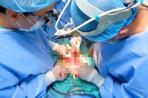 Ê kíp ghép tim của Bệnh viện Trung ương Huế tiến hành ca ghép tim kỷ lục. Ảnh: BV.