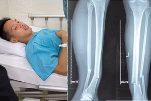 Ảnh: Đặng Phương Nam.