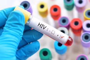 Bất ngờ sức khỏe của người nhiễm HIV đầu tiên ở Việt Nam 
