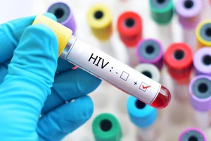 Bất ngờ sức khỏe của người nhiễm HIV đầu tiên ở Việt Nam 