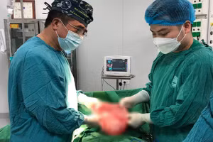 Bác sĩ cắt bỏ khối u cho bệnh nhân. Ảnh: BV.