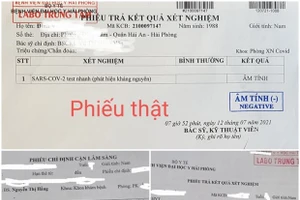 Kết quả xét nghiệm thật của Bệnh viện Đại học Y Hải Phòng (phía trên) và kết quả xét nghiệm giả mạo Bệnh viện Đại học Y Hải Phòng (phía dưới). Ảnh: TTXVN.