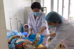 Các bác sĩ xử lý vết bỏng cho bệnh nhi. Ảnh: BVCC.