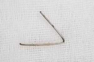 Di vật được gắp ra từ cổ họng bé gái. Ảnh: Bệnh viện Nhi đồng TP. Cần Thơ.