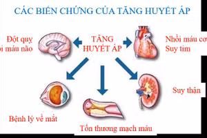Ảnh minh họa.