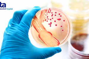 Đậu mùa khỉ có gây tử vong không?