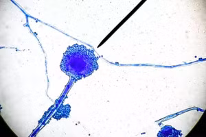 Nấm Mucormycetes gây ra bệnh "Nấm đen". Ảnh: Shutterstock.