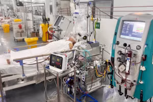 Bệnh nhân khi còn phụ thuộc vào ECMO. Nguồn: Bệnh viện Bệnh Nhiệt đới.