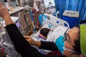 Một bệnh nhân Covid-19 45 tuổi đã tiêm vắc xin đầu tiên hai ngày trước khi phát bệnh, được đặt nội khí quản. Ảnh: Getty Images.