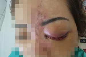 Ảnh minh họa: Infornet.