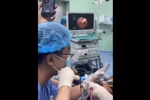 Ảnh cắt từ clip, nguồn: BV.