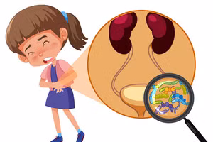 Tỉ lệ mắc bệnh ở bé gái mắc nhiều gấp 5 lần so với bé trai. Ảnh: BV. 