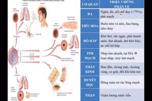 Video: Hướng dẫn theo dõi, xử trí phản ứng sau tiêm chủng vắc xin phòng Covid-19