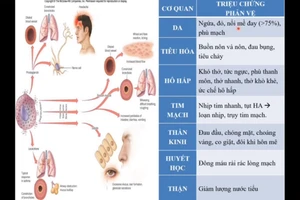 Video: Hướng dẫn theo dõi, xử trí phản ứng sau tiêm chủng vắc xin phòng Covid-19