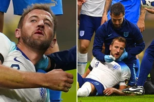 Harry Kane 'đổ máu', tuyển Anh vẫn bị loại khỏi Nations League 