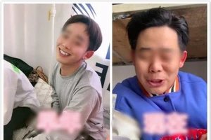 Hot Vlogger 19 tuổi qua đời vì làm quá nhiều video Mukbang