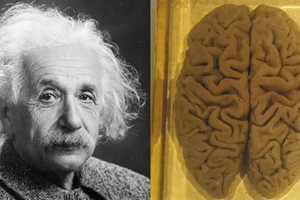 Những bi kịch về bộ não của Albert Einstein