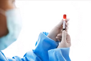 Việc xét nghiệm kháng thể sau tiêm vắc-xin ngừa Covid-19 là không cần thiết. Ảnh minh họa